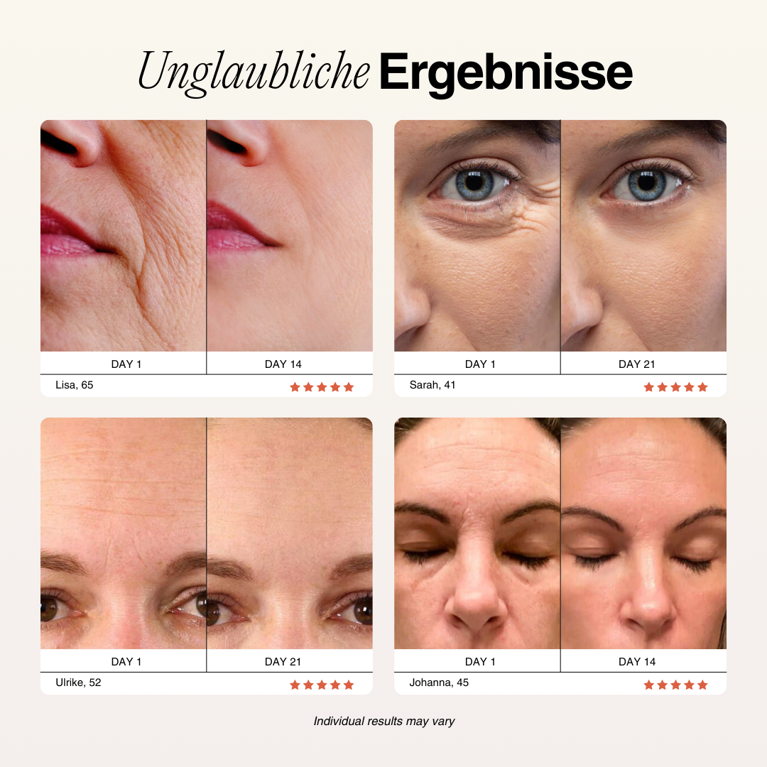 Dr. Severin One Pro 4-in-1 (+ 4 GRATIS SEREN)